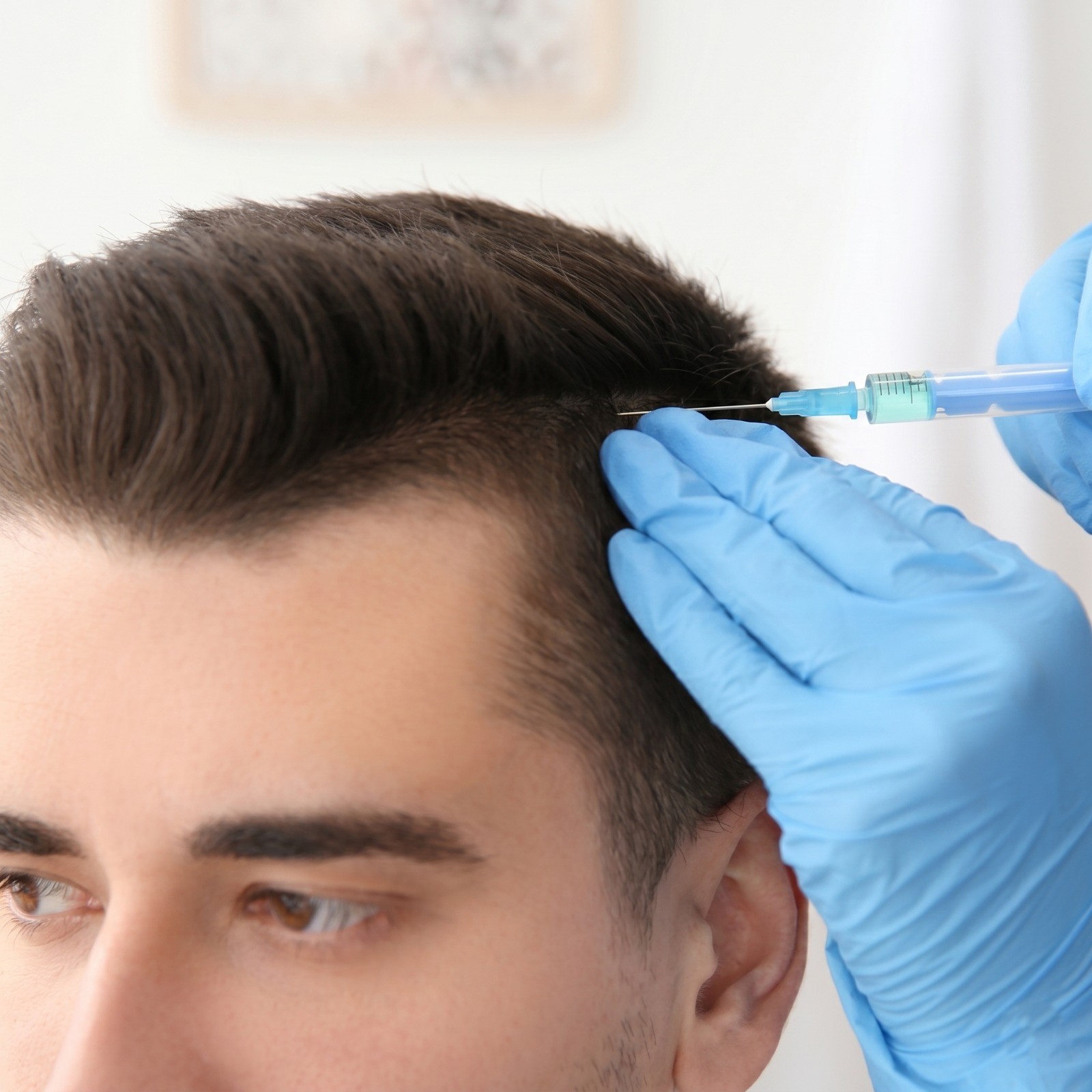 PRP-GFC therapy for hair and skin at COSMALIFE SKIN CLINIC