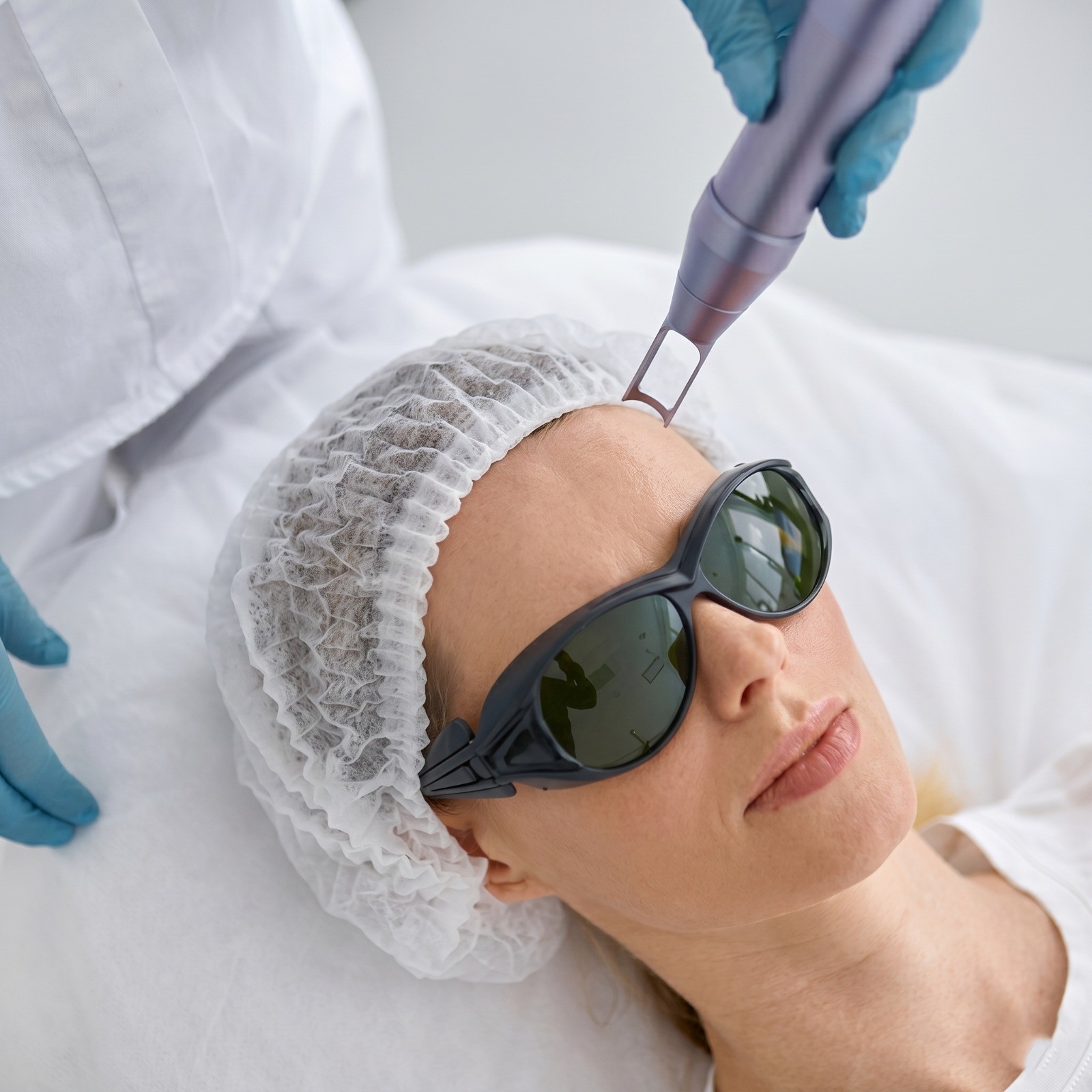 MNRF microneedling radiofrequency at COSMALIFE SKIN CLINIC